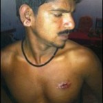 SL military assaults family man after playground dispute in Jaffna