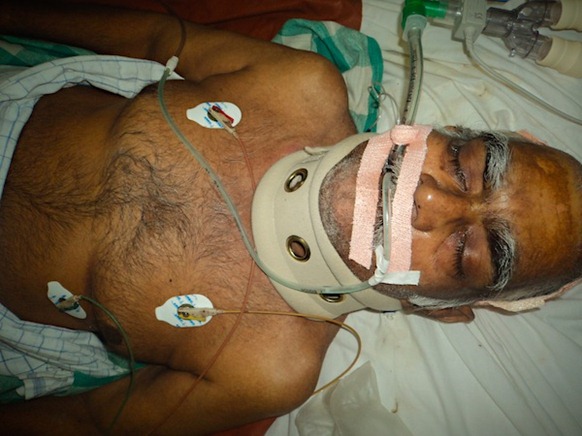 Kuganathan_in_hospital_02